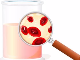 7 nguyên nhân tiểu ra máu thường gặp ở nam giới